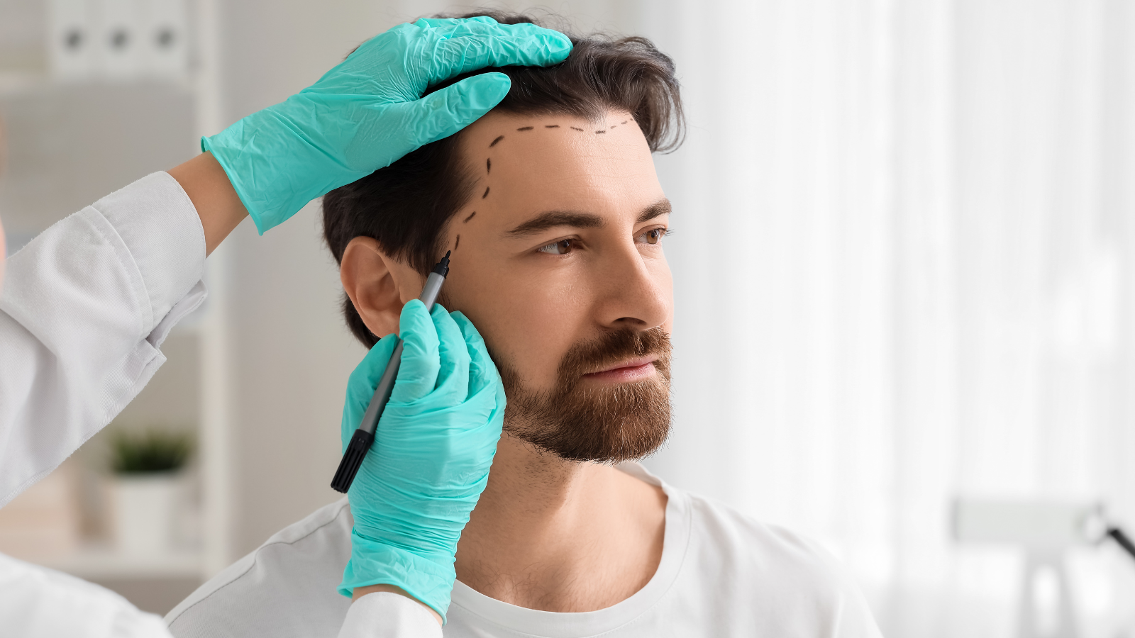 שיקום שיער דליל